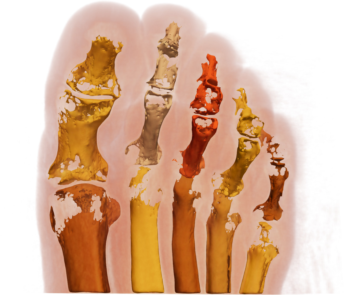 Robust segmentation